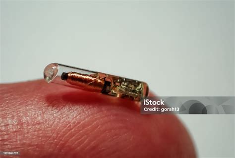 rfid chip in tooth|A radio frequency identification implanted in a tooth can .